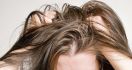 5 Langkah Mudah Menghilangkan Kutu Rambut - JPNN.com