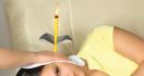 Ear Candling, Baik atau Buruk untuk Kesehatan? - JPNN.com