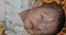 Astaga, Ada Bayi dengan Hidung di Jidat - JPNN.com