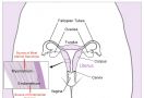 Peneliti: Melahirkan Bisa Turunkan Risiko Terkena Kanker Endometrium - JPNN.com