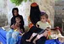 Astaga! Korban Perang Yaman Diserang Kolera - JPNN.com