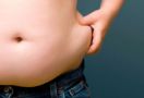 Penderita Obesitas Ingin Menurunkan Berat Badan, 4 Cara Ini Bisa Membantu Anda - JPNN.com