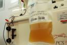 Australia Kembangkan Terapi Plasma Darah untuk Pasien COVID-19 - JPNN.com