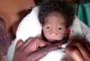 Ada Bayi Baru Lahir, Langsung Terlihat Lebih Tua Ketimbang Ibunya - JPNN.com
