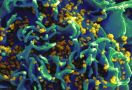 Metode Sel Dendritik Vaksin Nusantara Berguna Buat Peneliti Prancis - JPNN.com
