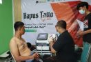 Bantu Kuatkan Hijrah Masyarakat, BMH Yogyakarta Gelar Layanan Hapus Tato - JPNN.com