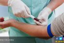 Deteksi Dini Kanker Pankreas dengan Tes Darah - JPNN.com