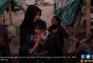 Malanutrisi Cabut Nyawa Bocah Yaman - JPNN.com