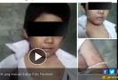 Tak Hanya Disiram Air Panas, Bocah Ini Kerap Dipukuli Ibunya - JPNN.com