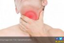 10 Cara Mengatasi Suara Serak Karena Sakit Tenggorokan - JPNN.com