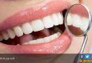 3 Tips Mudah Memutihkan Gigi Secara Cepat - JPNN.com