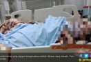 Gadis yang Dibakar Pacarnya Itu Akhirnya Meninggal Dunia - JPNN.com