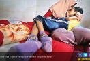Evan Derita Radang Otak, 10 Tahun hanya di Tempat Tidur - JPNN.com