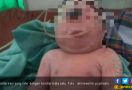 Bayi Terlahir dengan Hanya Mata Satu di Kening Itu Meninggal - JPNN.com