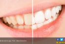 3 Cara Mudah Putihkan Gigi yang Menguning - JPNN.com