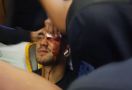Bus Diserang OTK, Kepala Dua Pemain Persib Berdarah - JPNN.com