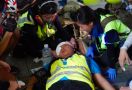 Wartawati asal Indonesia Kena Peluru Saat Liput Demo di Hong Kong - JPNN.com