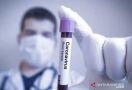 Waduh, Otoritas Tiongkok Temukan Virus Corona di Cumi-Cumi Impor - JPNN.com