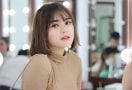 Bibir Terlihat Berbeda, Amanda Manopo Lakukan Operasi? - JPNN.com