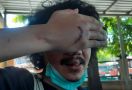 Mau Cari Makan untuk Sahur, Jurnalis Detikcom Dikeroyok Sampai Babak Belur - JPNN.com