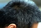 Atasi Uban Rambut yang Mengganggu dengan 6 Pengobatan Alami Ini - JPNN.com