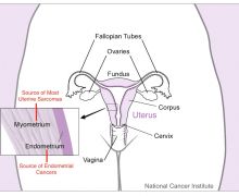Peneliti: Melahirkan Bisa Turunkan Risiko Terkena Kanker Endometrium - JPNN.com