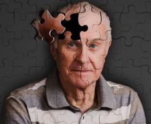Penyebab Sakit Gusi Ditengarai Berperan pada Alzheimer - JPNN.com