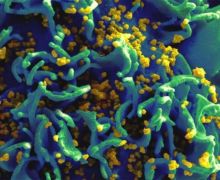 Metode Sel Dendritik Vaksin Nusantara Berguna Buat Peneliti Prancis - JPNN.com