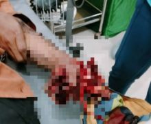 Detik-detik Tangan Mirda Hancur Terkena Ledakan Petasan, Bikin Merinding - JPNN.com