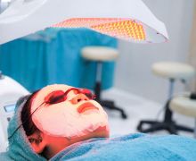 Treatment Pico Laser Bikin Kulit Sehat dan Cantik, Apa Itu? - JPNN.com