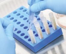 Stem Cell Bisa jadi Alternatif Penyembuhan Cedera Organ Tubuh - JPNN.com