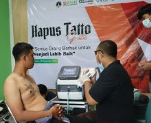 Bantu Kuatkan Hijrah Masyarakat, BMH Yogyakarta Gelar Layanan Hapus Tato - JPNN.com