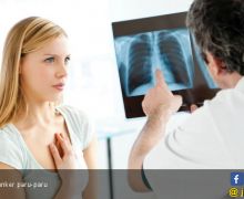 Ini Tiga Jenis Radioterapi untuk Pengobatan Pasien Kanker - JPNN.com