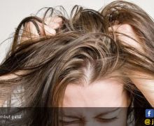 5 Langkah Mudah Menghilangkan Kutu Rambut - JPNN.com