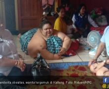 Titi Wati Obesitas Bukan karena Sering Minum Air Es, tapi… - JPNN.com