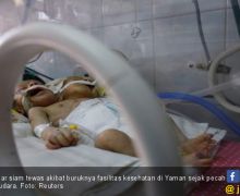 Miris, Bayi Kembar Siam Jadi Korban Perang Yaman - JPNN.com