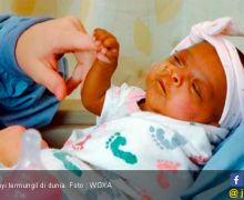 Bayi Prematur Terkecil di Dunia, Bobot Hanya Seberat Apel - JPNN.com