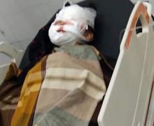 Bocah Perempuan 8 Tahun Terluka Parah Digigit Anjing Pitbull Peliharaan, Tragis! - JPNN.com