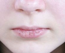 Ini Cara Mudah Agar Bibir Tak Kering saat Berpuasa - JPNN.com