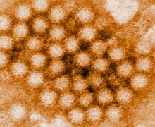 CDC: Kasus Norovirus di Amerika Serikat Terus Meningkat Tajam - JPNN.com