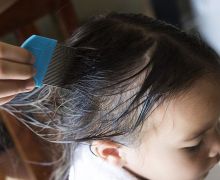 Gadis 4 Tahun ini Nyaris Meninggal Akibat Infeksi Kutu Rambut, Jangan Dianggap Remeh - JPNN.com