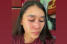 Oknum Polisi Diduga Menganiaya Wanita Muda, Wajah Korban Memar-Memar - JPNN.com