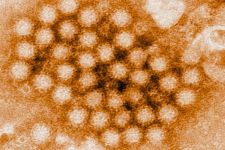 CDC: Kasus Norovirus di Amerika Serikat Terus Meningkat Tajam - JPNN.com