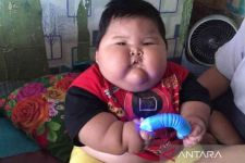 Penjelasan Dinkes Bekasi Ihwal Muhammad Kenzi Alfaro, Sang Balita Obesitas yang Viral di Medsos - JPNN.com Jabar