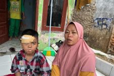 Diserang Monyet Liar, Bocah 7 Tahun di Depok Alami Luka Robek 10 Jahitan di Dahi - JPNN.com Jabar