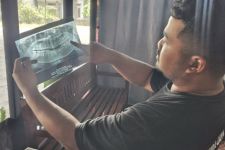PDGI Selediki Kasus Perempuan di Ngawi Meninggal Seusai Cabut Gigi  Bungsu - JPNN.com Jatim