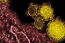 Virus Mematikan MCov Diduga Berasal dari Kelelawar - JPNN.com