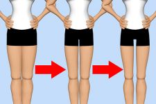 Thigh Gap, Obsesi Merampingkan Paha di Kalangan Remaja - JPNN.com