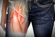 Awas! Jangan Terlalu Lama Kenakan Skinny Jeans, 'Itunya' Bisa Kepanasan - JPNN.com