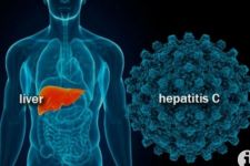 Kasus Hepatitis Akut Terdeteksi di Bekasi - JPNN.com Sultra